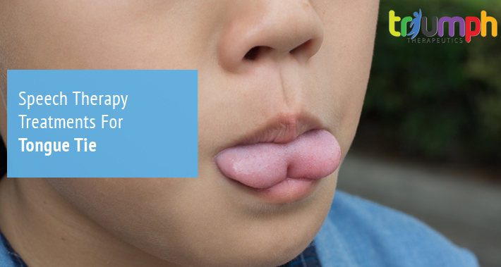 Speech Therapy Treatments For Tongue Tie | Triumph Therapeutics | Speech Therapy, Occupational Therapy, Physical Therapy in Washington DC