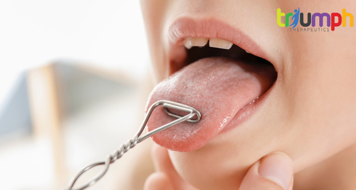speech therapist diagnosing tongue thrust in children | Triumph Therapeutics | Speech Therapy, Occupational Therapy, Physical Therapy in Washington DC