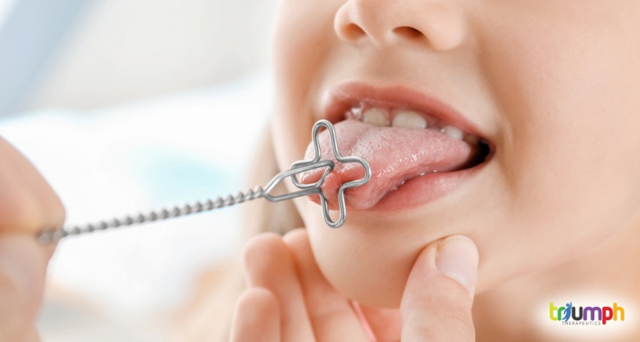 speech therapist diagnosing tongue thrust in children | Triumph Therapeutics | Washington DC Pediatric Therapists